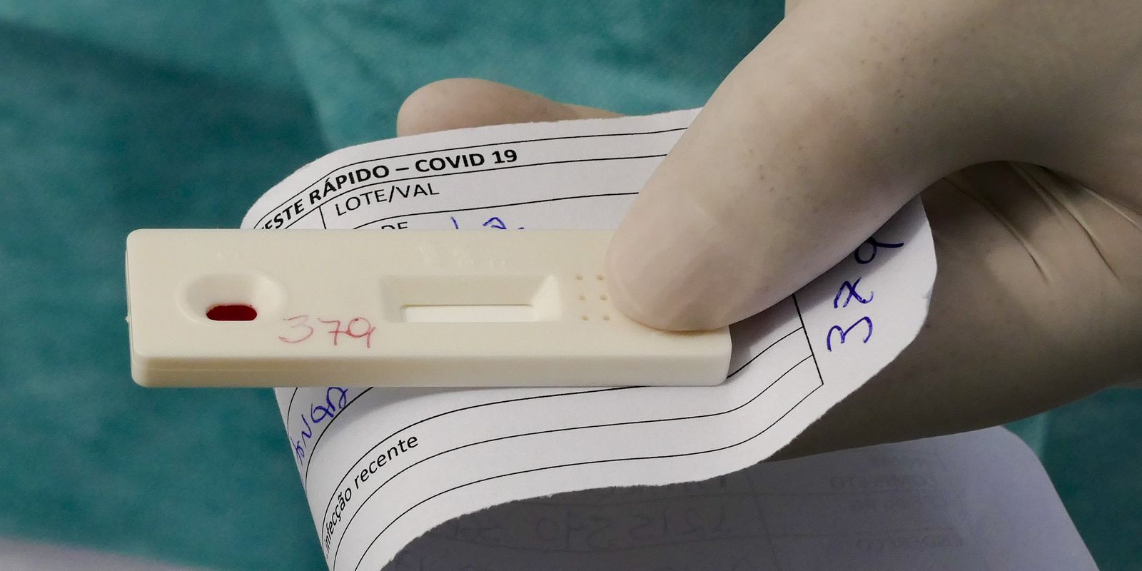 Foto de teste de covid positivo: saiba como identificar o resultado correto (dicas fáceis!)