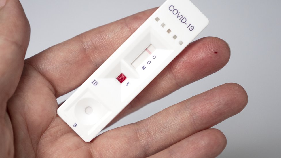 Foto de teste de covid positivo: saiba reconhecer seu resultado agora mesmo